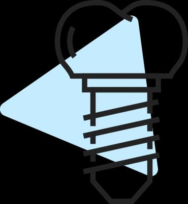 Tandimplantat: Allt du behöver veta