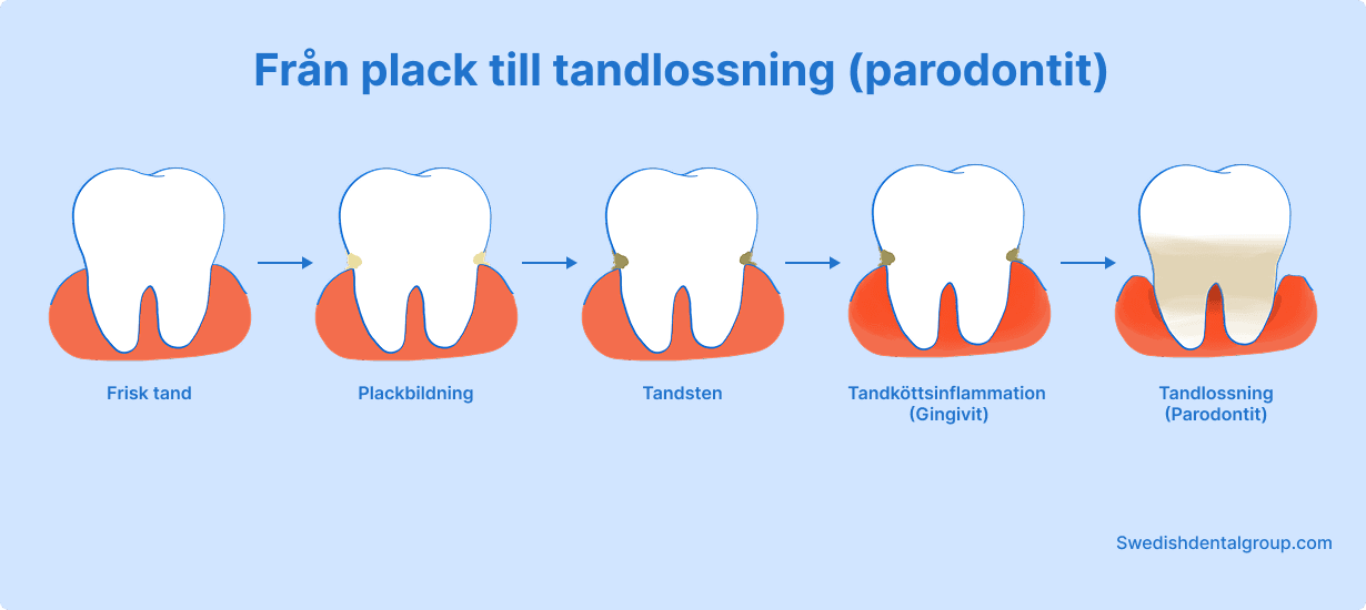 Gum Disease / Periodontitis – What Is It and How Does It Develop?